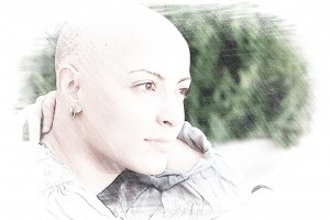Наращивание волос после химиотерапии